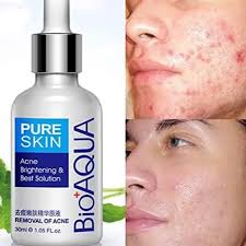 Serum Anti Acne BioAQUA