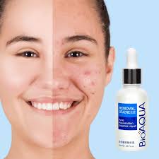 Serum Anti Acne BioAQUA